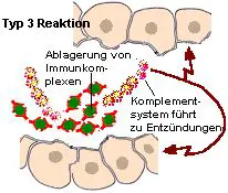 Immunkomplexe knnen sich in Geweben ablagern und dort Allergien hervorrufen.
